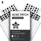 360pcs Invisible Pimple Patches – Anti-Acne Spot Dots