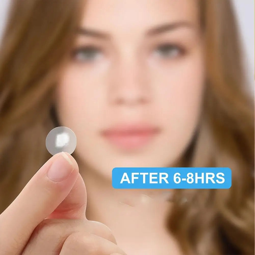 360pcs Invisible Pimple Patches – Anti-Acne Spot Dots