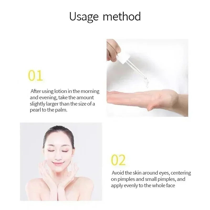 Garnier Vitamin C Serum – 30ml Brightening & Acne Spot Fading